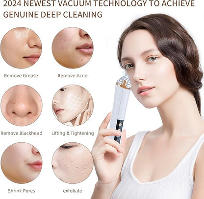 Blackhead Remover Pore Vacuum Kit  USB Rechargeable